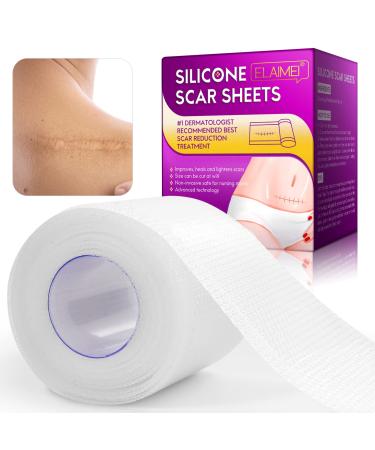 Silicone Scar Sheets  Clear Scar Tape | Silicone Scar Tape Roll | Silicone Scar Strips  Reusable And Effective Scar Removal Sheets For C-Section Surgery Scar  Keloid  Burn  Acne (2-1.6 x 60   1.5M)