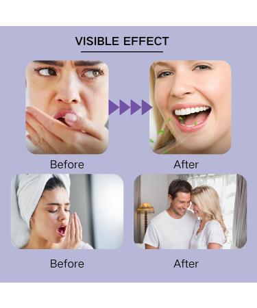 2Pcs Microcrystalline Hydroxyapatite Powder Hydroxyapatites Toothpaste Microcrystalline Tooth Powder for Stain Removal Teeth Cleaning Fresh Breath - Buy Online on GoSupps.com