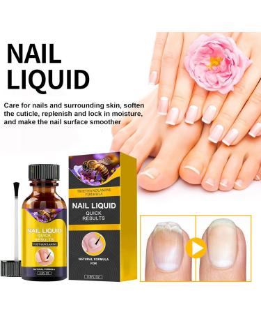 Fungal Nail Treatment For Toenails Extra Strong - Nail Fungus Treatment - Moisturize Cuticle Care Oils for Ingrown Toenails - Toenail Growth for Repairing Damaged & Discolored Nails(30ML) - Buy Online on GoSupps.com