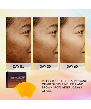 VALITIC Kojic Acid Dark Spot Remover Paper Soap - Travel Size - 300 Dissolvable Sheets - Acne & Dark Spot Treatment with Vitamin C, Retinol, Collagen & Turmeric - 3 Pack - Buy Online on GoSupps.com