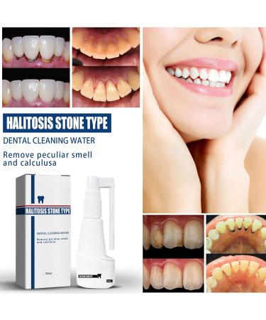 Ultimate Tooth Whitening Spray | Remove Tartar & Yellow Stains - Fresh Breath & Bright Smile - Buy Online on GoSupps.com