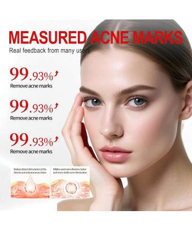 Waymaytecy 25g antiblemish gel for face antipimple gel oil control and hydration lighten acne spots and pimples suitable for men and women white - Buy Online on GoSupps.com