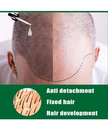 Ginger Anti Hair Loss Serum for Hair Regrowth - Men & Women - 3pcs 1 Fl Oz - Buy Online on GoSupps.com