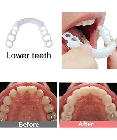 2 Pairs Regain Confidence Smile Temporarily Adjustable for Men and Women - Buy Online on GoSupps.com