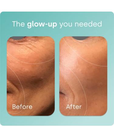 Biosil Collagen Booster Supplement - 60 Original Capsules - Patented ch-OSA Activator for Skin Hair Nails & Joints - Supports Natural Production - 30-Day Supply 60 Original Caps (Pack of 1) - Buy Online on GoSupps.com