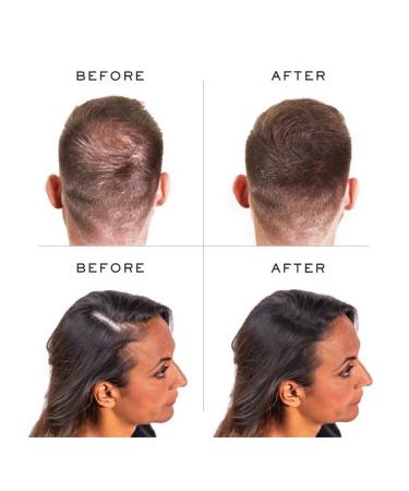 PROCOVR Hair Loss Concealer Cream with DHT Blockers - Saw Palmetto & Rosemary Extract | Hairline Enhancer & Root Touch Up | Natural Alternative to Hair Fibers & Powder - Buy Online on GoSupps.com