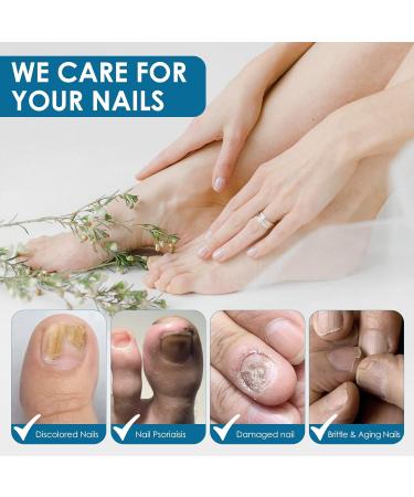 Extra Strength Nail Repair Drop for Toenail Fungus Treatment - Restores Appearance of Discolored Nails - Natural Herbal Extract - 1 Count - Buy Online on GoSupps.com