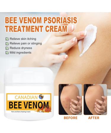 FLLUOUZH 2 Pcs Bostore Canadian Bee Venom Alleviating Bone Pain Bostore Canadium Bee Venom Cream Bee Venom Joint Relief Cream for Back Neck Hands Feet - Buy Online on GoSupps.com