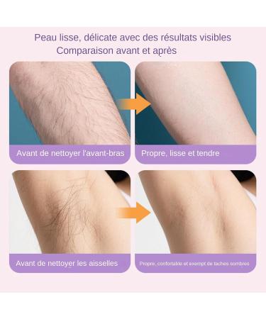 Tondeuse lectrique Corporelle Rasoir pilateur pour le Visage | Tondeuse Portable Multifonction pour les Oreilles les Sourcils les Bras les Parties Intimes la Barbe les Cuisses les Jambes - Buy Online on GoSupps.com