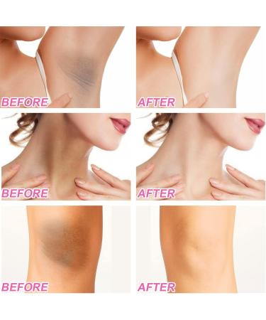 Armpit Repair Lightening Cream Whitening Cream Use Under the Armpit Whitening Cream Natural Underarm Armpit Whitening Cream Lightening Cream for Armpit Underarm Whitening Cream - Buy Online on GoSupps.com