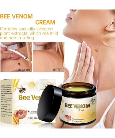 2pcs Bee Venom Cream Wree Bee Venom Removal&Cream 2024 New Bee Venom Repair Cream for Men Women - Buy Online on GoSupps.com