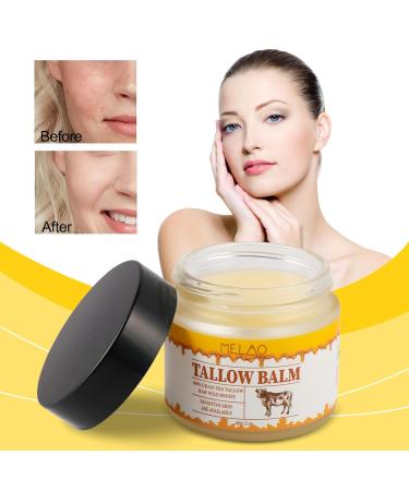 Natural Beef Tallow Cream - Nourishing Body Lotion for Sensitive Skin | Grass Fed Non-Greasy Moisturizer with Honey - International Shipping Available - Buy Online on GoSupps.com