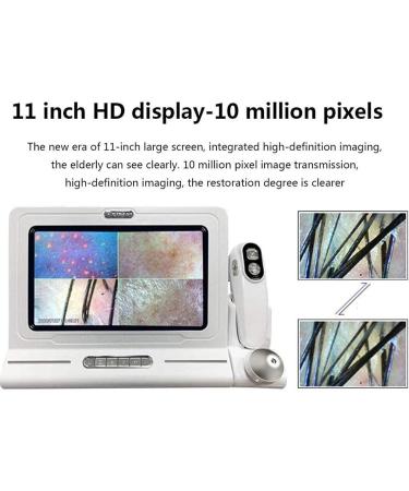 Hair Follicle Facial Skin Oil Moisture Tester Skin Hair Scalp Detector with 11 Inch 200x Lens 50x Lens Pixels 1000W ABS Resin Hair Follicle Testing and Skin Analysis Magnifier - Buy Online on GoSupps.com