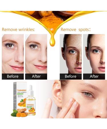 Turmeric Serum Dark Spots 30 ml Spot Corrector Face & Body Anti Aging and Wrinkle Face Serum Reduces Hyperpigtation Age Spots Sun Spot Improve Skin Tone Moisturize Brighten All Types - Buy Online on GoSupps.com