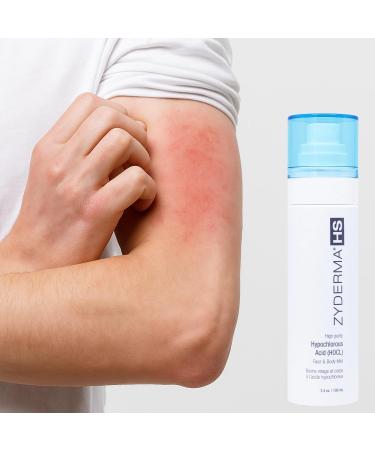 Zyderma Face & Body Mist HOCl Facial Mist for Sensitive Skin Redness Irritation Soothes Skin Fine Mist Spray for Post-Workout Tattoos Daily Skin Repair Solution 3.4oz - Buy Online on GoSupps.com