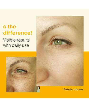 Double Size 20% Vitamin C Serum for Face with Hyaluronic Acid - Anti-Aging Facial Serum for Women - Buy Online on GoSupps.com