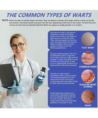 Aimery Wart Remover Liquid | Gentle Botanical Formula for Plantar Common & Flat Warts - Safe & Effective International Shipping - Buy Online on GoSupps.com