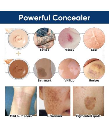 Tattoo Cover Up Concealer - Waterproof and Natural-looking | 2 Colors for Tattoos, Scars, Dark Spots, Birthmarks, Vitiligo - Buy Online on GoSupps.com