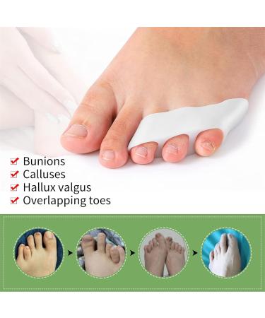 Toe Spreader Silicone - 4 Pcs Small Toe Separator for Overlapping Toes Pain Relief & Correction - Buy Online on GoSupps.com