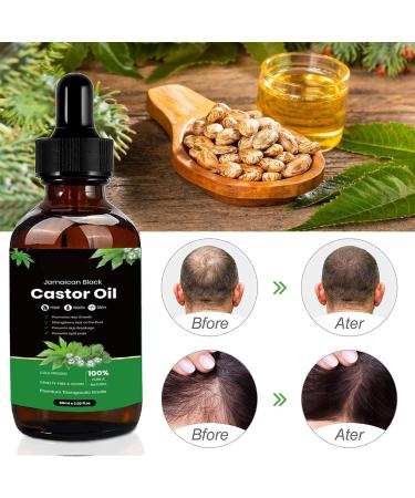 KAIYOCA 2 Pack Jamaican Black Castor Oil for Hair Growth 100 Pure Cold Pressed Castor Oil for Hair Eyelashes Eyebrows Aromatherapy Massage Oil - Buy Online on GoSupps.com