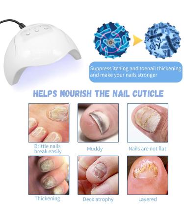 Get Rid of Nail Fungus Fast: Mecctuck & Furzero Laser Devices | Effective Nail Fungus Treatment - Buy Online on GoSupps.com