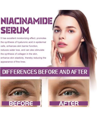  SKZKK Niacinamide Face Serum 20%: Brightening Firming Moisturizing Anti-Wrinkle Evening Smoothing Fine Lines Reducing Pigmentation Pore Care for Sensitive Skin (2pcs) - Buy Online on GoSupps.com