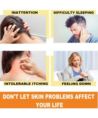 Bee Venom Psoriasis Treatment Cream - Soothing and Moisturizing Skin Relief - 3PCS - Buy Online on GoSupps.com