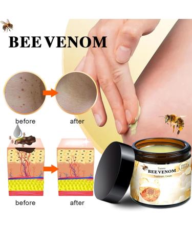 Turonutm Bee Venom Skin Treatment Cream - AAD Recommended for Effective Skin Care | Face & Body All Skin Types | Fast Results (2 Cans 1 Fl Oz - Buy Online on GoSupps.com