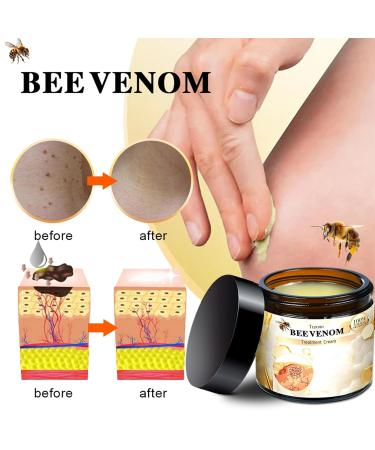 ZVLZVL Bee Venom Treatment Cream - All-Natural Hydrating Repair for Men & Women | Professional Skin Care Solution 1 Fl Oz - Buy Online on GoSupps.com