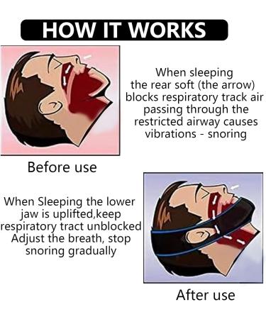 AZWOOD Adjustable Anti Snore Chin Strap - Effective Snoring Solution for Men and Women - Comfortable Stopper Snore Sleep Aid - Buy Online on GoSupps.com