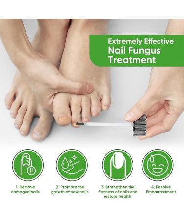 Extra Strength Toenail Fungus Treatment with Tea Tree Oil Extract - 30mL - Buy Online on GoSupps.com