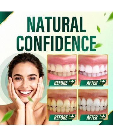 Fresh Breath Capsules Breath Freshener 7 in 1 Powerful Solution With Chlorophyllin Mint Extract Magnesium Citrate & Probiotic Blend Eliminate Bad Breath From The Inside Out (1) - Buy Online on GoSupps.com