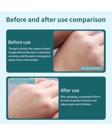 No Sting Barrier Film Spray 30ml - No-Alcohol Skin Prep & Adult Adhesive Spray - 3 Bottles | International Shipping Available - Buy Online on GoSupps.com