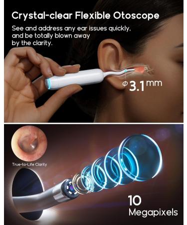 Bebird Home 30S Ear Camera System - Ear Cleaner with Flexible Otoscope UVC Light & Tweezers - Effective Ear Wax Removal Tool for Adults & Kids - Buy Online on GoSupps.com