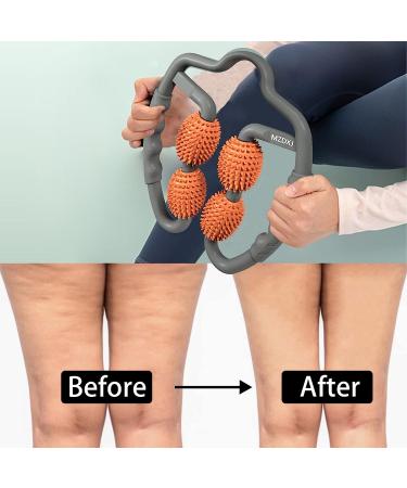 MZDXJ Fascia Muscle Roller - Cellulite Massager for Trigger Points - Reduce Soreness, Tightness in Calves, Legs, Arms & Shoulders - Deep Tissue Massage Tool in Orange Gray - Buy Online on GoSupps.com