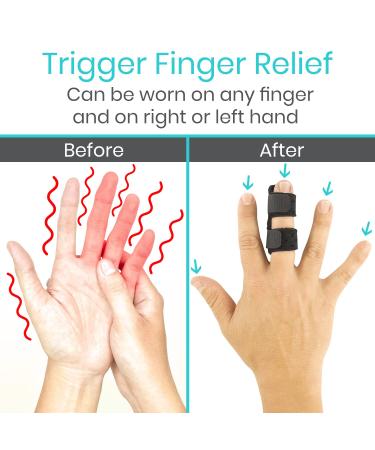 Vive Finger Splint (2 Pack) - Universal Finger Straightener for Arthritis and Pain Relief - Adjustable Brace for Trigger and Broken Fingers - Support for Middle, Index, Ring, Pinky - Black - Buy Online on GoSupps.com