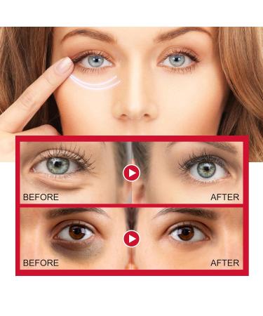 Retinol Eye Stick & Cream for Dark Circles | Anti-Aging Under Eye Balm | Moisturize & Firm Skin - Buy Online on GoSupps.com