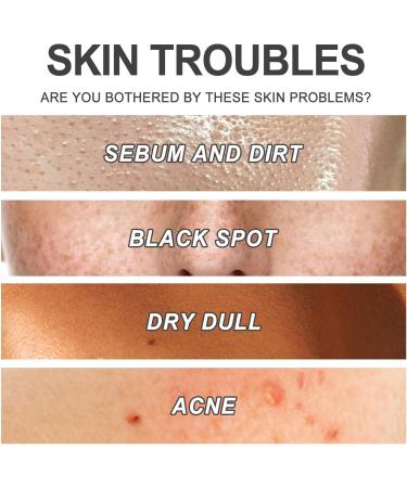 Natural Face Scrub Exfoliator Aloe Vera Facial Scrub Gel Deep Exfoliating Face Wash Exfoliating Scrub Organic Aloe Vera Face Exfoliator for Blackheads Dark Spot & Acne Clean Pore Oil Control - Buy Online on GoSupps.com