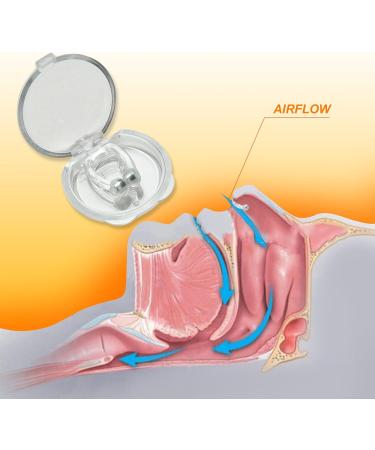 Snoring Solutions for Nasal Snorers - Mobi Lock Pack of 30 | Vents Strips & Clips in Various Sizes - Buy Online on GoSupps.com