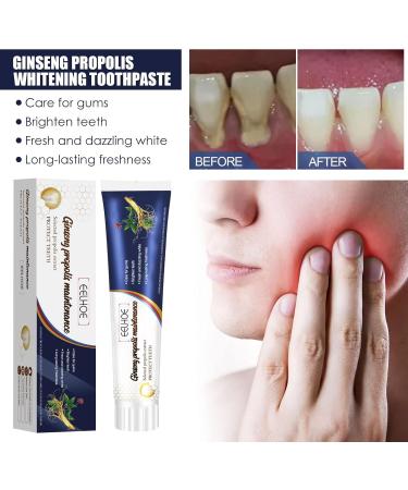 Toothpaste for loose teeth Toothpaste for loose teeth care Ginseng Propolis Protection Toothpaste Deep Cleansing Care Toothpaste - Buy Online on GoSupps.com