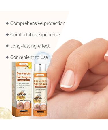 Bee Venom Nail Fungus Soothing Spray - Extra Strength Toenail Treatment (20ml) | Natural Nail Fungus Relief - Buy Online on GoSupps.com