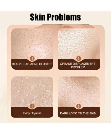 Facial Scrub Vitamin C Face Exfoliator Energising Exfoliating Scrub with Natural Fruit Acids and Enzymes Removes Blackheads Improves Acne Dark Spots Cleanses Skin Brightens Radiance - Buy Online on GoSupps.com
