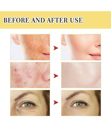 Snail Mucin 96% Power Repairing Essence 3.38 fl.oz - Hydrating Serum with Snail Secretion Filtrate for Dark Spots and Fine Lines - 100ml Face Moisturizer Set - Buy Online on GoSupps.com