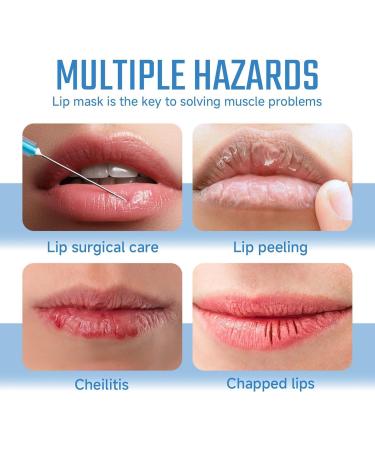 Hydrating Lip Patch Anti-cracking Lip Treatments Lip Contour Care Film Nourishing Lip Brightening Lip Patch Lip Elasticity Restoration Moisturizing Lip Film Overnight Lip Care Treatments - Buy Online on GoSupps.com