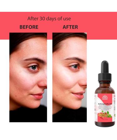 Relaxcation Ashwagandha Infused Herbal Oil Organic Sesame Carrier Oil for Skin Hair and Body | Cold Macerated Hexane Free Travel Size | Natural Vata Extract for Scalp & Glow Rituals (4 oz) 4 Fl Oz (Pack of 1) - Buy Online on GoSupps.com