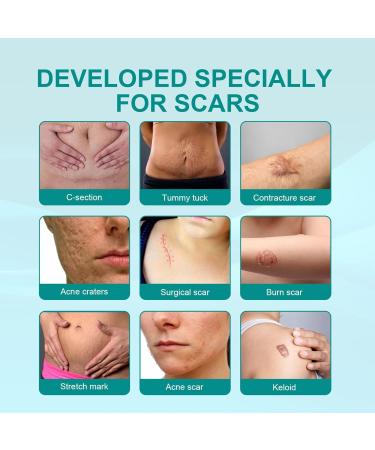 UVOGGFUA Scar Remove Advanced Spray - Medical Grade Scar Treatment for All Types of Scars - Gentle Skin Care - 2pc Set - Buy Online on GoSupps.com