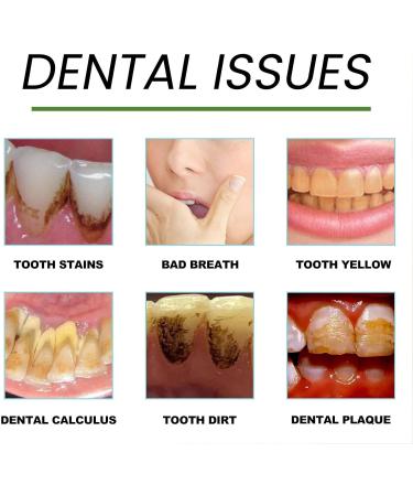 Brightening Toothpaste for Stain Removal | Refreshing Breath & Sensitive Teeth | Daily Oral Care for Adults | Biological Formula - Buy Online on GoSupps.com
