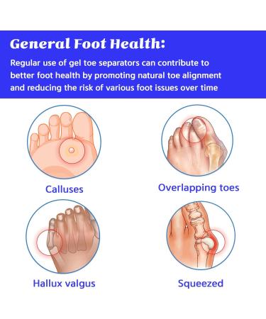 3 Pairs Toe Separators & Metatarsal Pads Soft Breathable Foot Cushions for Blisters Morton s Neuroma Diabetic Feet & Bunion Pain Relief - Perfect for Comfort - Buy Online on GoSupps.com