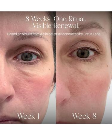 Advanced Marine Collagen Peptides + Bundle with Liposomal Marine Collagen & Glutathione Powder Sticks Triple-Action Beauty Support Premium Peptides Antioxidants & Liposomal Delivery for Daily Rad - Buy Online on GoSupps.com