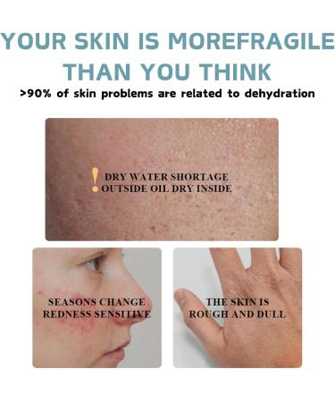 Body Butter for Women - Shea Butter with Niacinamide Squalane Hyaluronic Acid - Body Butter for Anti-Wrinkles & Skin Tightening - Body Skin Care - Shea Butter Organic - Buy Online on GoSupps.com